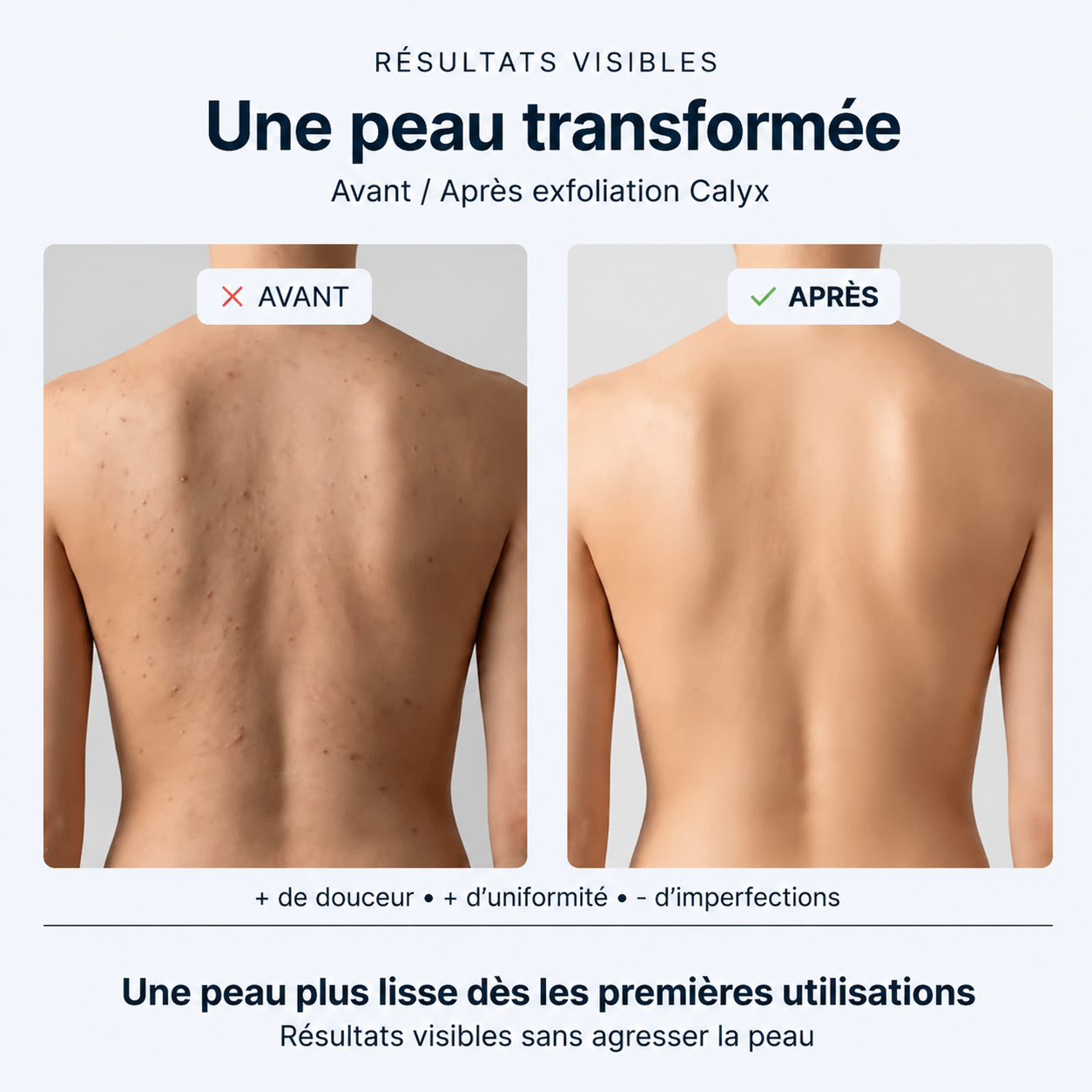 Calyx™ Serviette de douche exfoliante