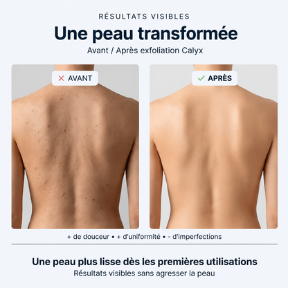 Calyx™ Serviette de douche exfoliante